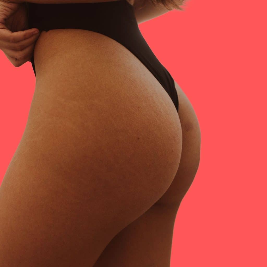 The buttocks enhancement cream improves the buttocks' shape, firmness, and definition