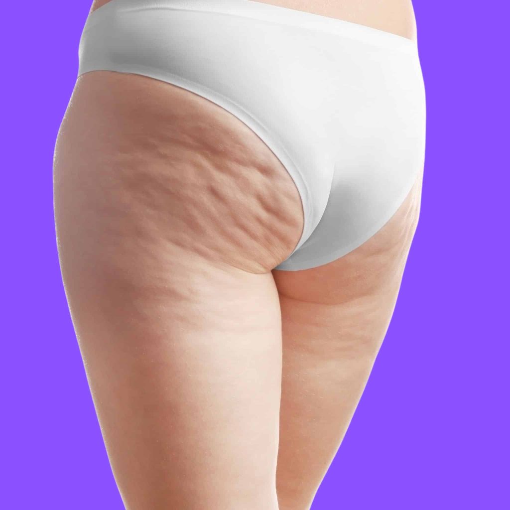 The natural buttocks enhancement cream helps you remove that saggy skin from your butt